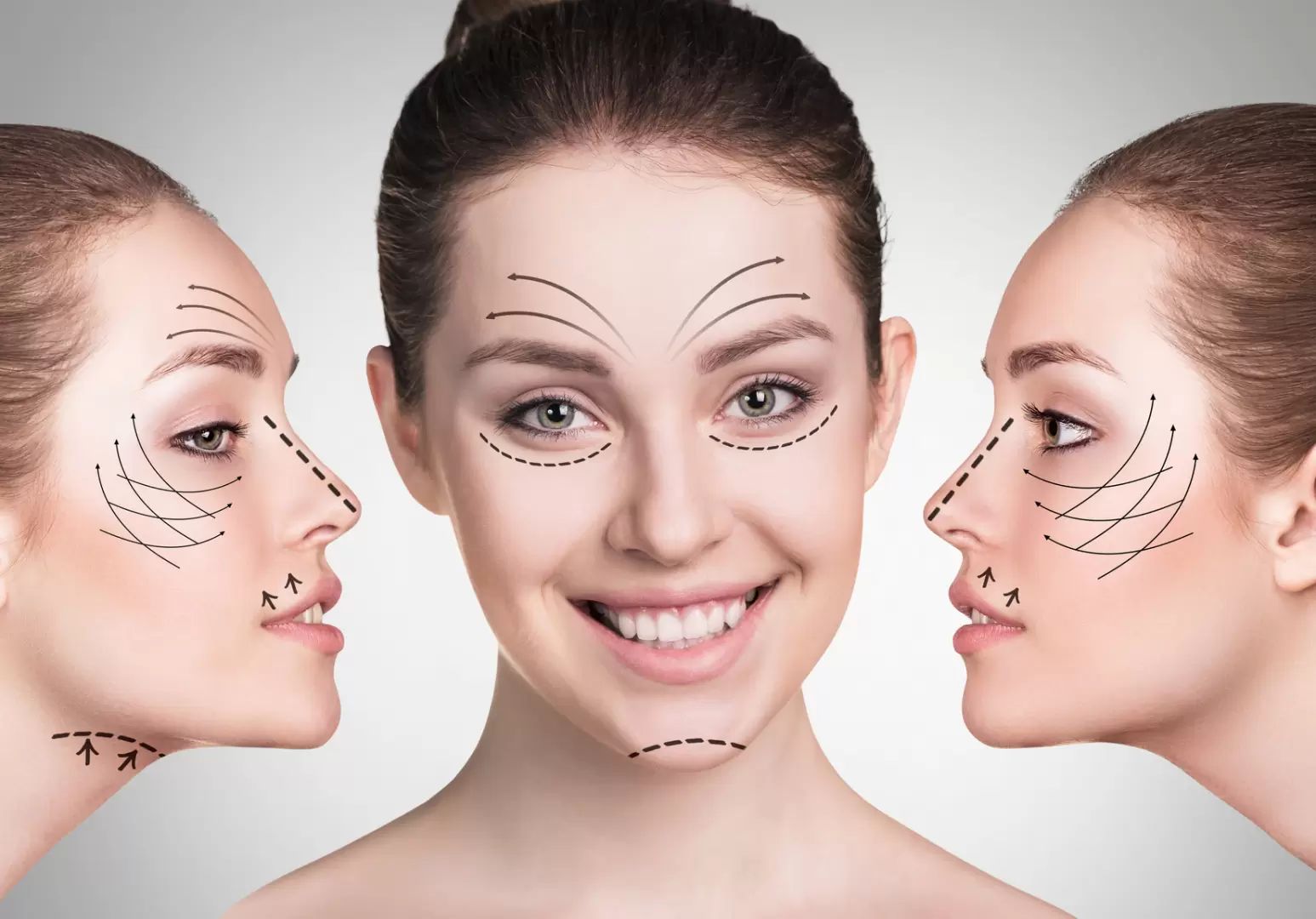 Choisissez une technique appropriée du lifting du visage en consultant un spécialiste esthétique expérimenté
