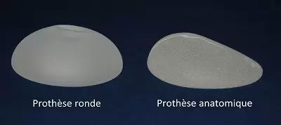 implant mammaire ronde vs anatomique